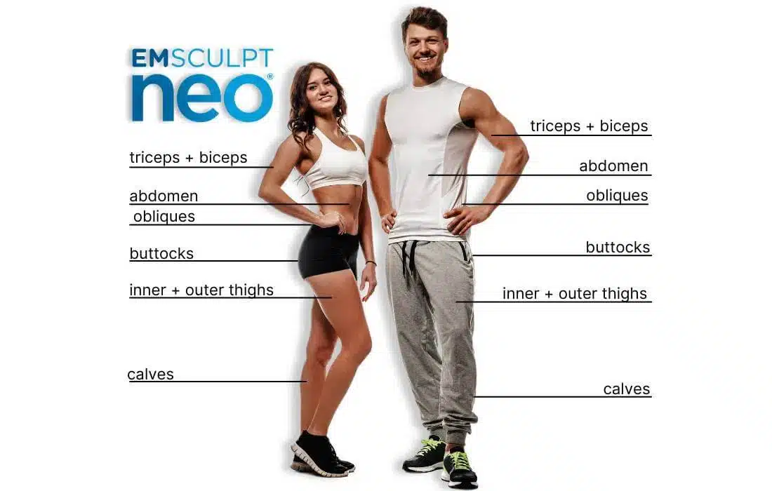 A photo of a couple showing the areas of treatment for Emsculpt NEO.