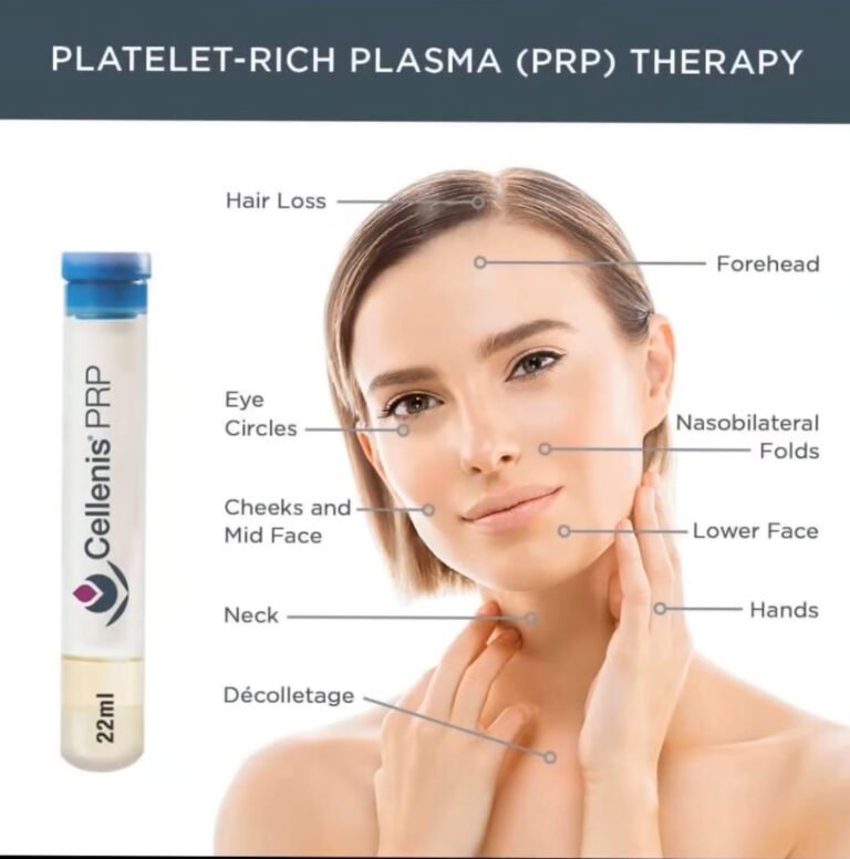 Platelet-Rich Plasma (PRP)