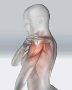Platelet-Rich Plasma (PRP) Solution for injured shoulder