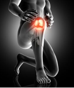 Platelet-Rich Plasma (PRP) Solution for injured knee