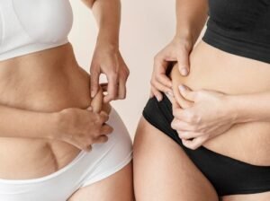 lipo free