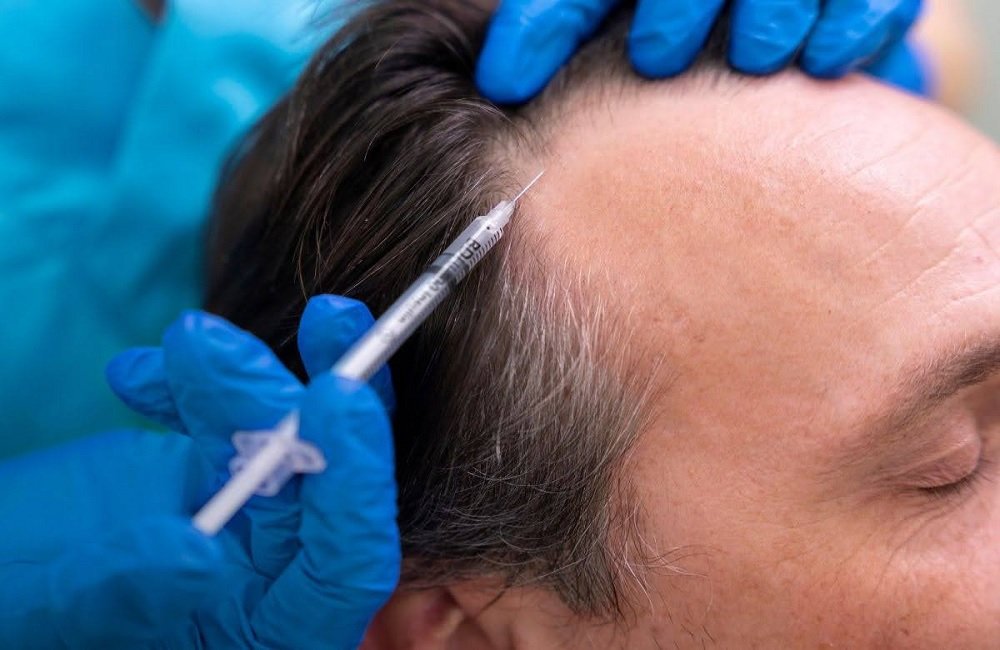 Platelet-Rich Plasma (PRP)