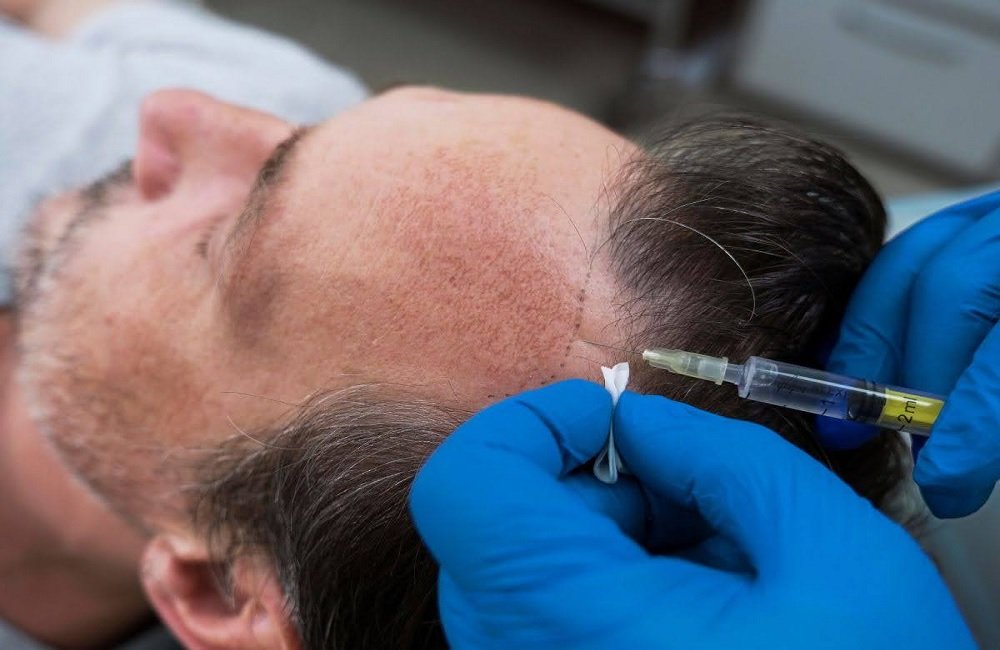 Platelet-Rich Plasma (PRP)
