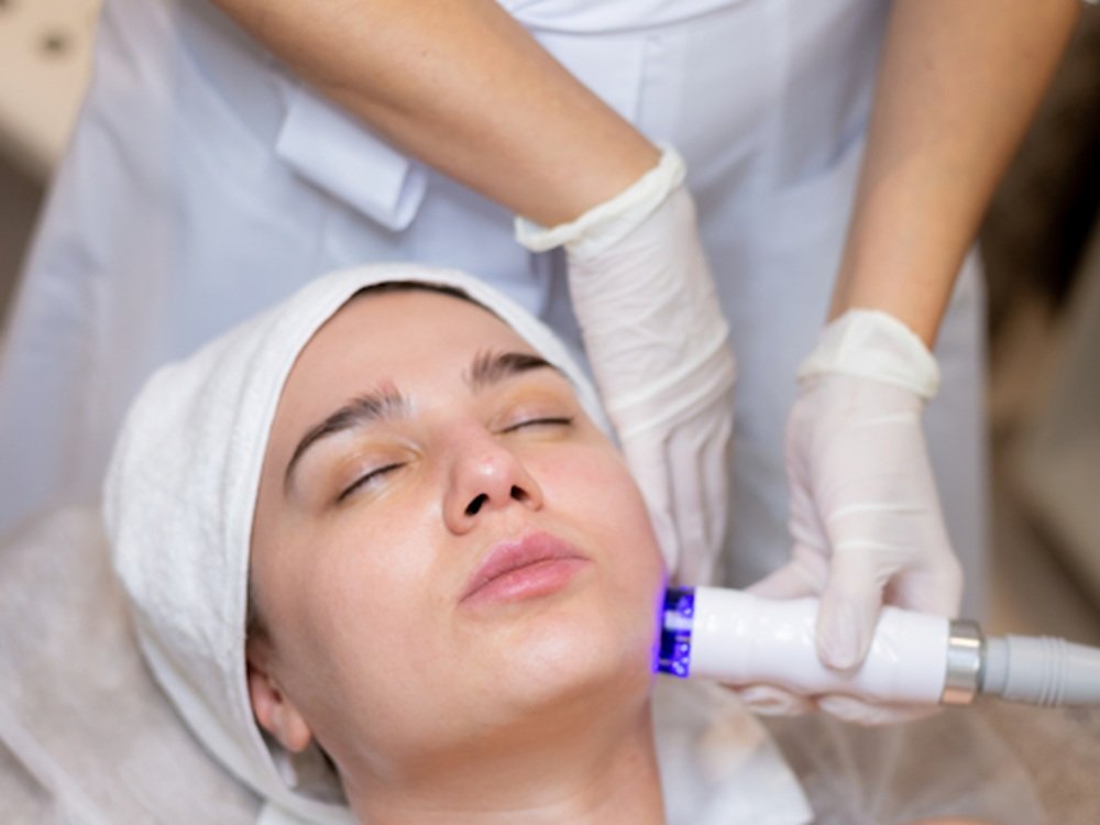 ADVA laser treatment