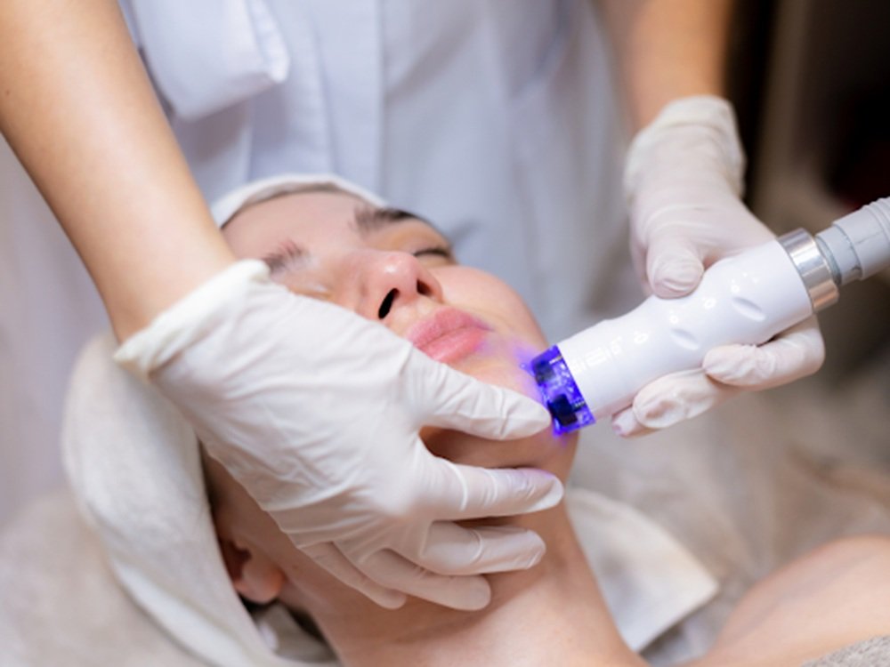 ADVA Laser Treatment